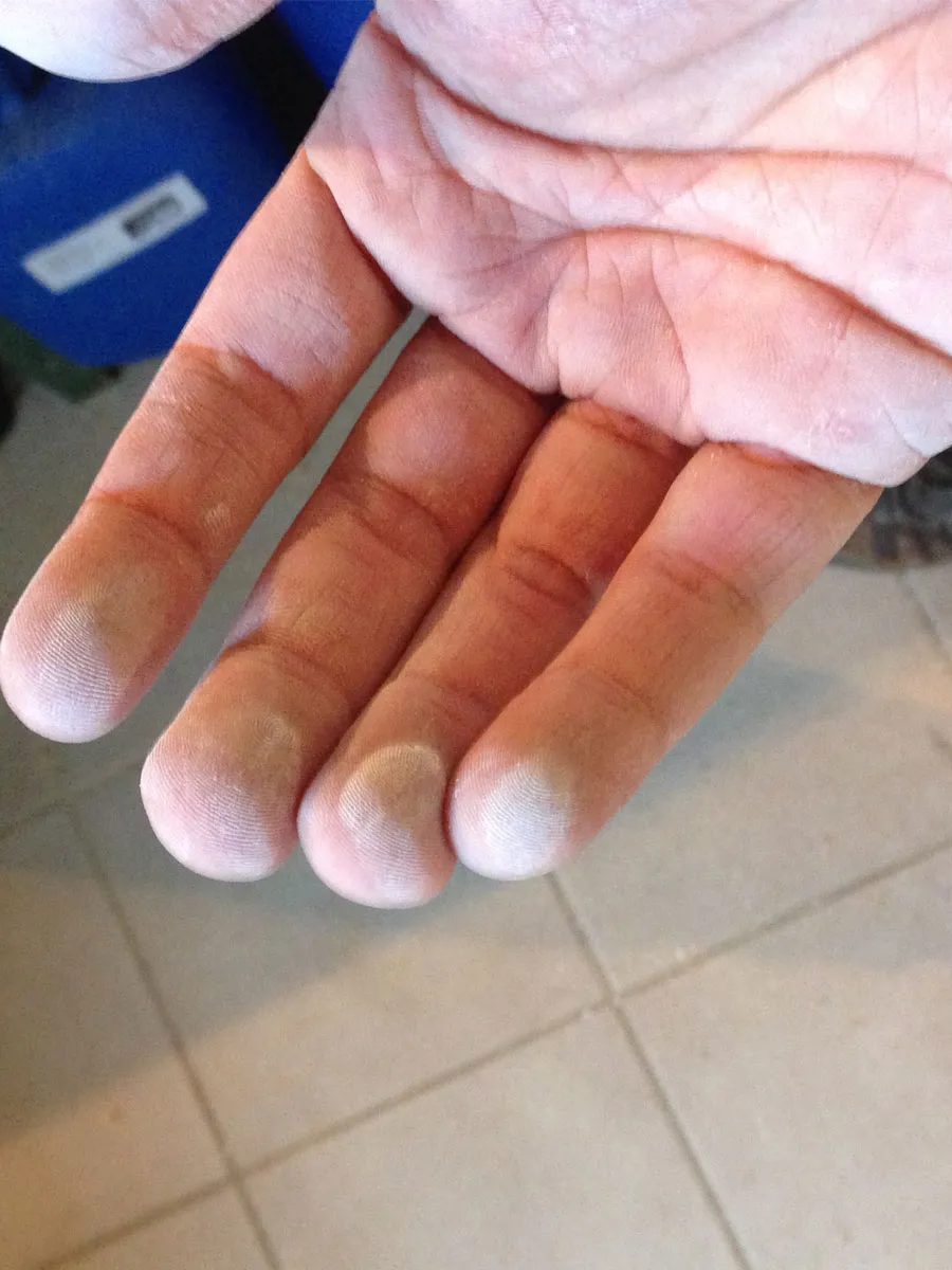 Outcome of Polishing